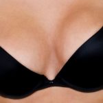 Breast Augmentation